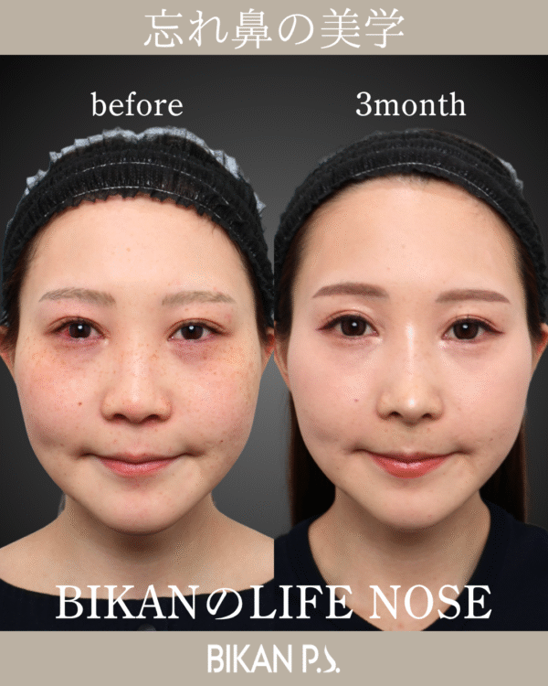 自然な仕上がり × LIFE NOSE