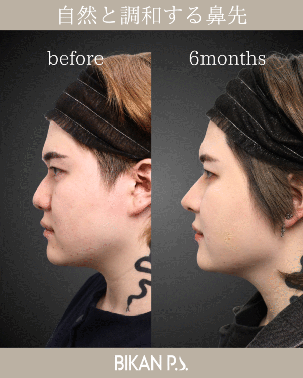 自然と調和する鼻先