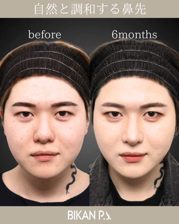 自然と調和する鼻先