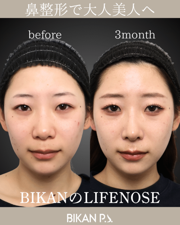 自然と調和する鼻先