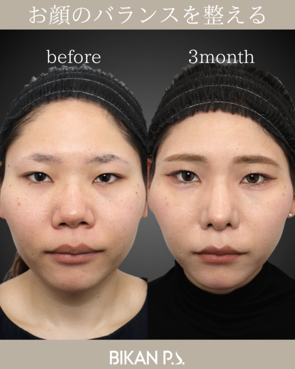 お顔のバランスを整える