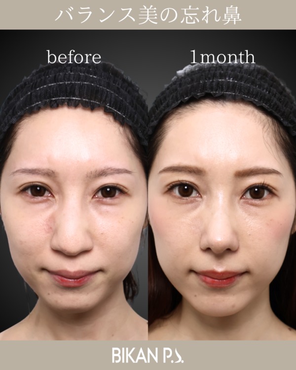 バランス美の忘れ鼻