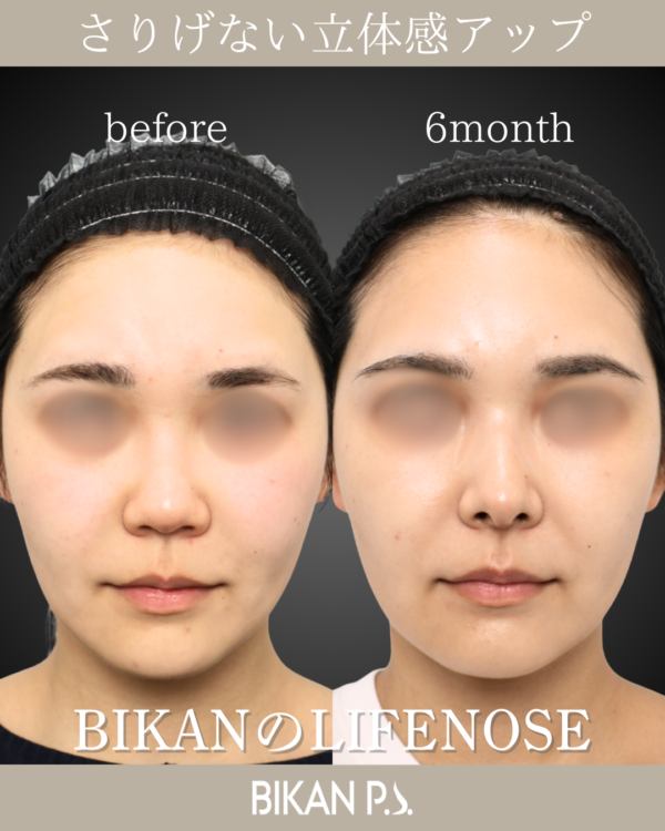 さりげない立体感アップ