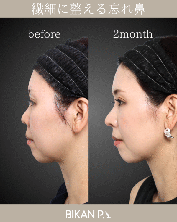 繊細に整える忘れ鼻