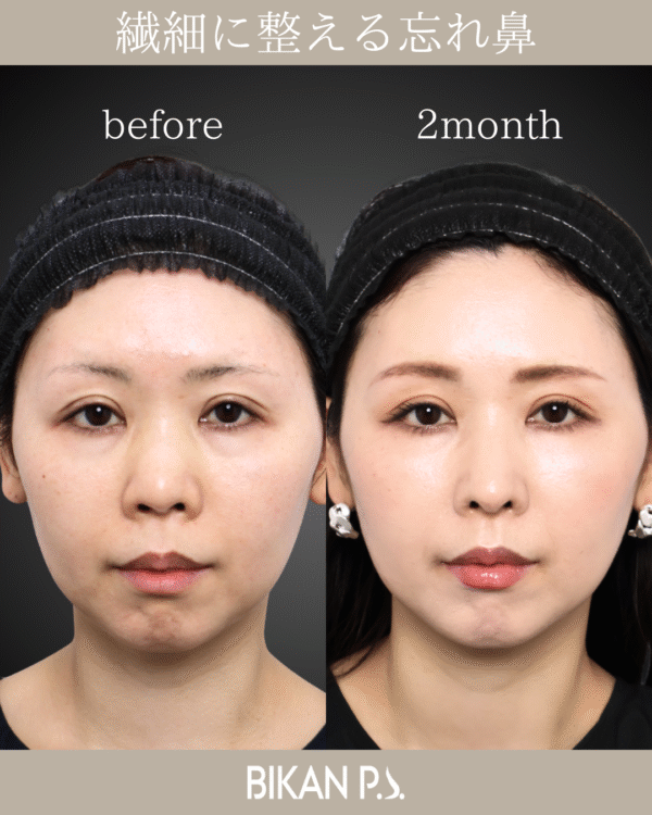 繊細に整える忘れ鼻