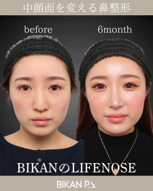 美しさと安全、両方を諦めない選択