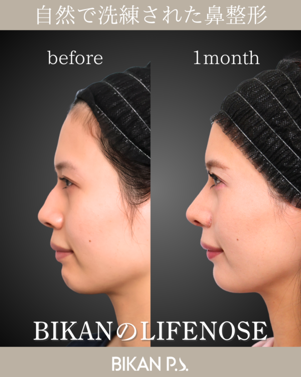 顔の中心は少しの変化で大きく変わる