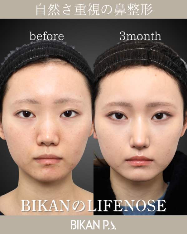 自然に垢抜け。さりげない忘れ鼻