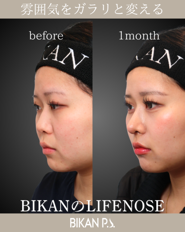 骨格が変わって見える。LIFE NOSE