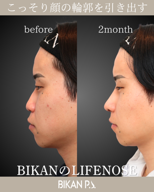 派手すぎない垢抜け。中顔面を形成