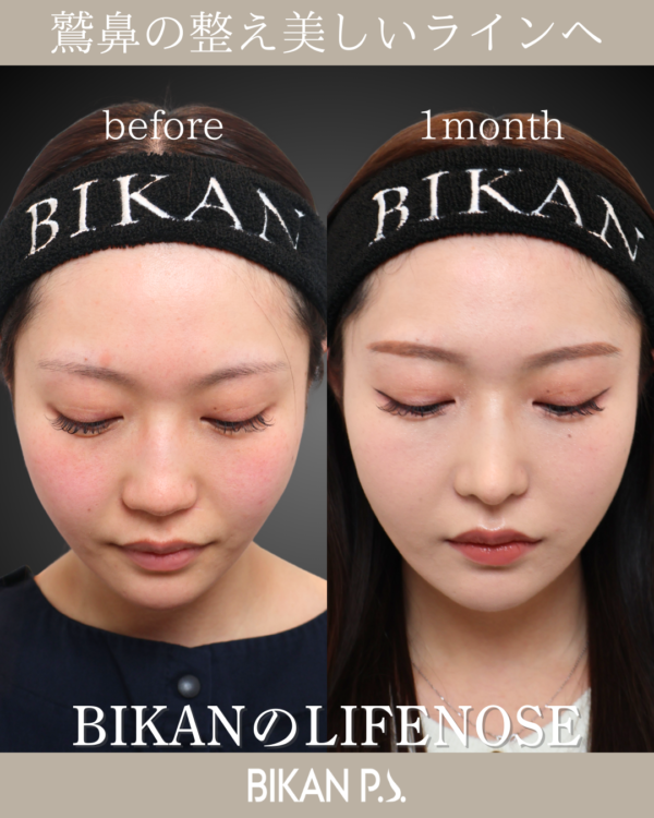 フル「自家組織」で安全にこっそり垢抜け