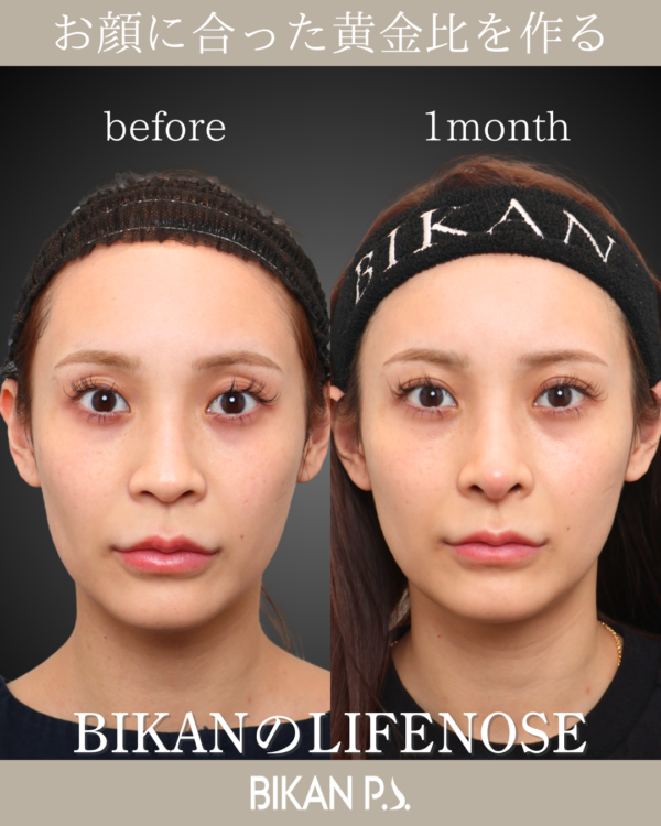 鼻先の丸みは残し、ナチュラルに仕上げる