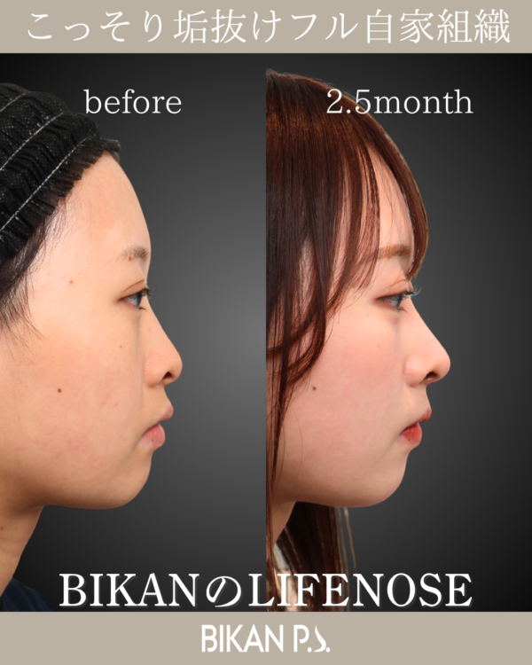 ナチュラルに垢抜ける。鼻先LIFE NOSE