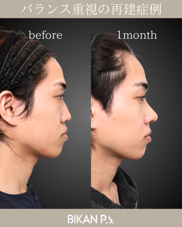 機能面の改善。ここまで変わるLIFE NOSE