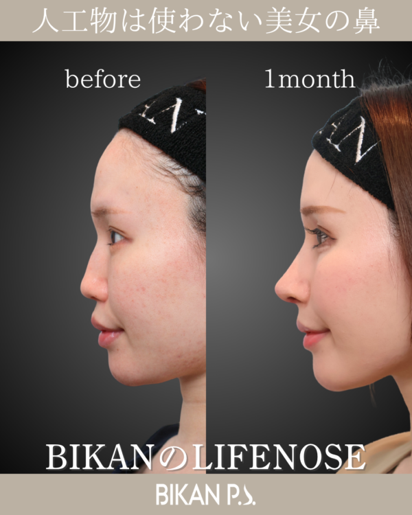 適度な変化で印象をガラッと変えるLIFENOSE