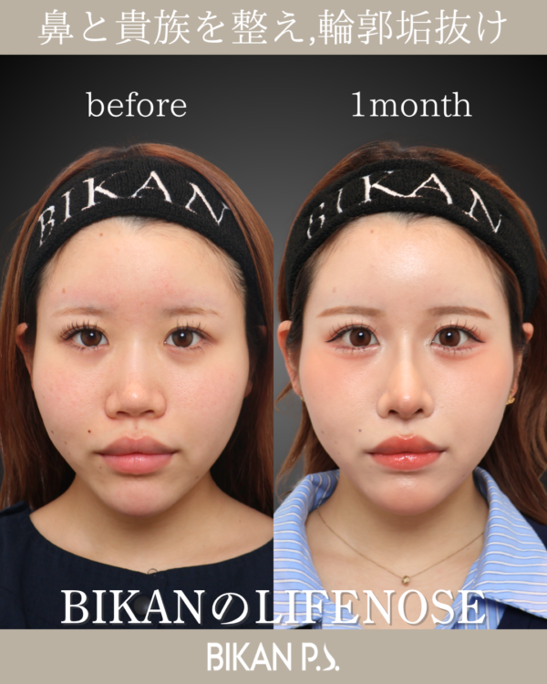 貴族と鼻フルで選ばれる理由。LIFE NOSE