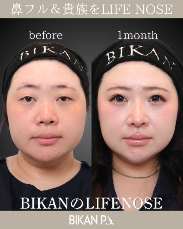 輪郭と印象をガラッと変えるLIFE NOSE